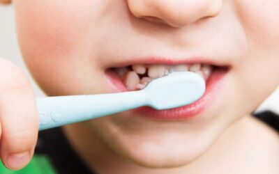 Fluorosis dental ¿Qué es? Causas y tratamientos