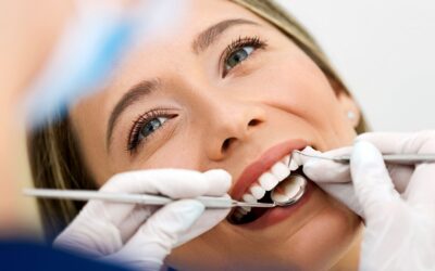 Profilaxis dental: así se hace una limpieza bucal profesional paso a paso