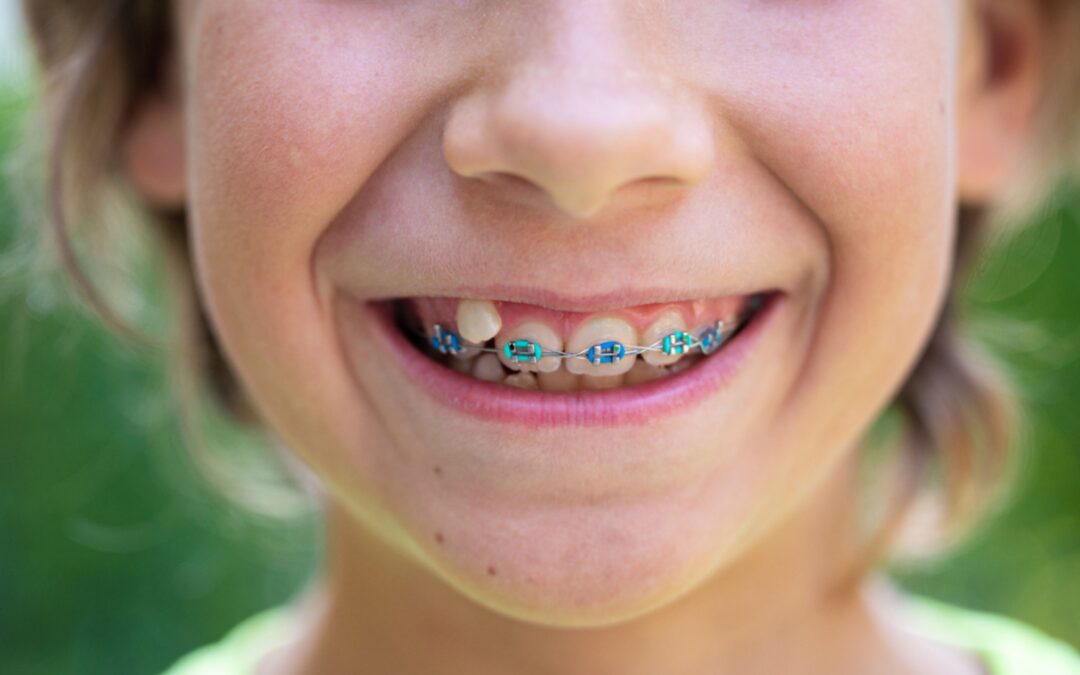 ¿Qué problemas corrige la ortodoncia para niños?