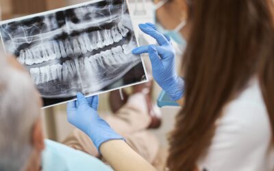 Tratamientos dentales para la pérdida de hueso