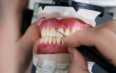 Prótesis dentales; guía para el cuidado óptimo