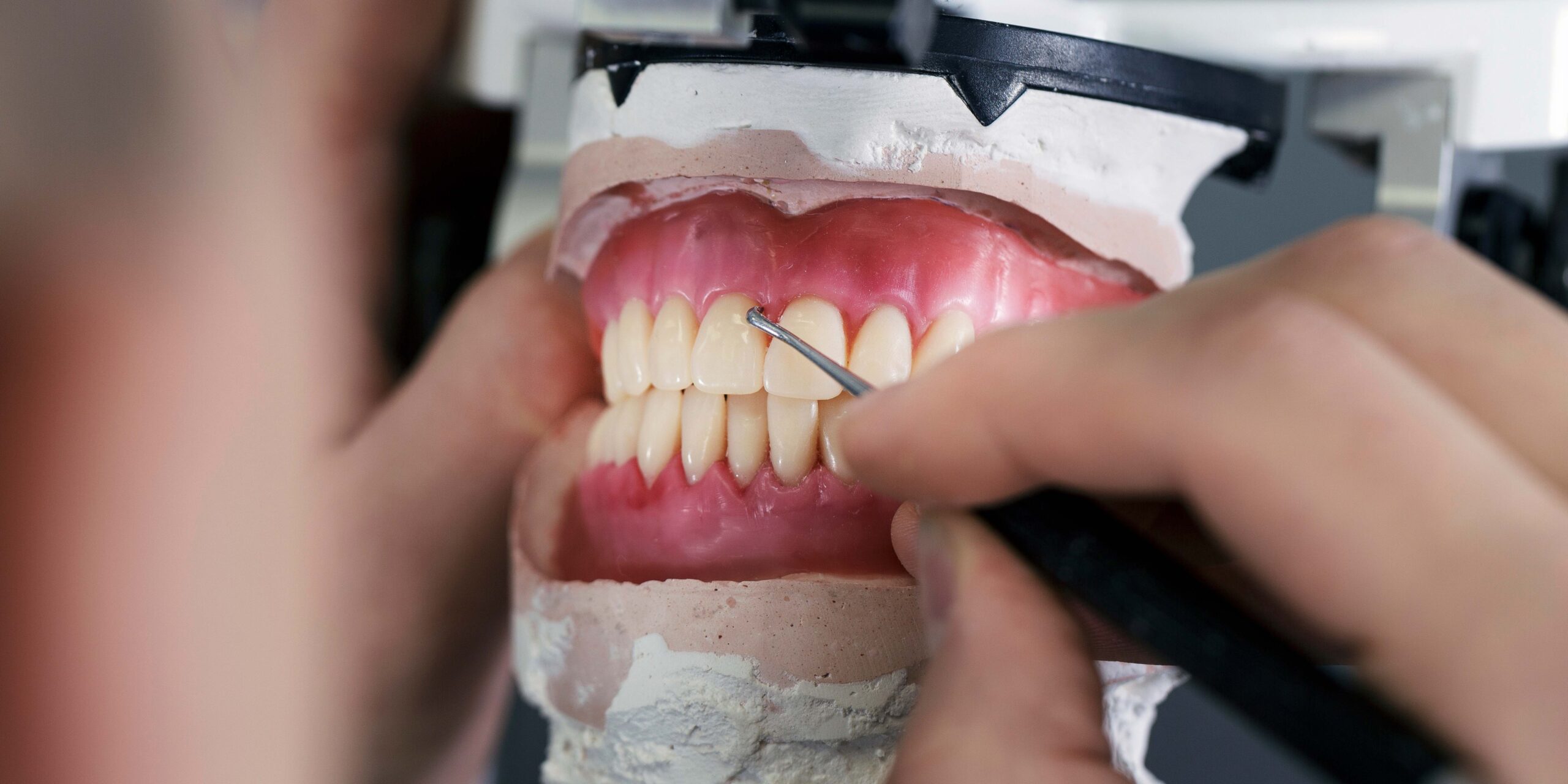 prótesis dentales