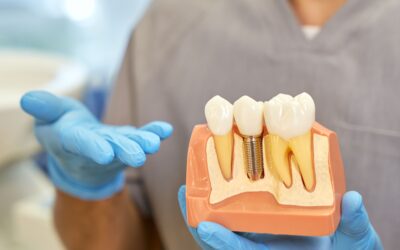 Implante dental en Vinaròs: paso a paso en Clínica Dental Soto