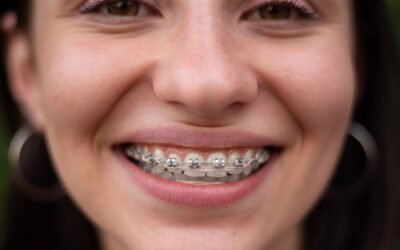 ATM y ortodoncia: cómo el alineamiento dental puede aliviar el dolor mandibular